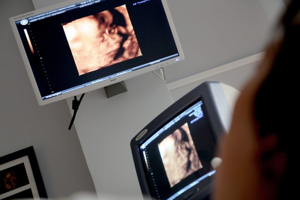 Ultrasound imaging, late term abortion occur in the second and third trimester of pregnancy.